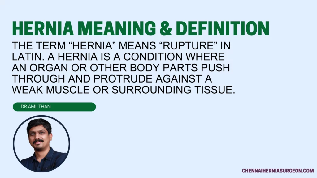 Hernia Meaning & Definition