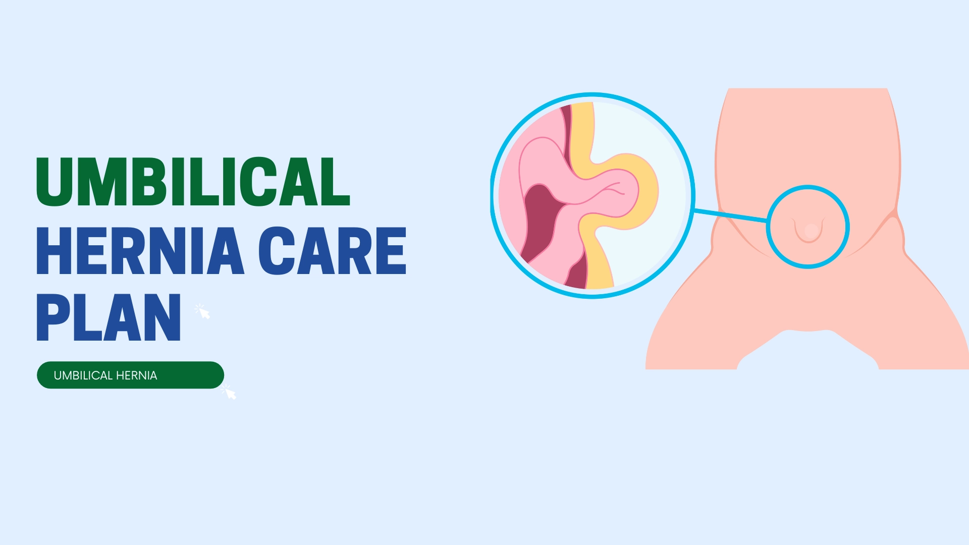 Umbilical Hernia Care Plan