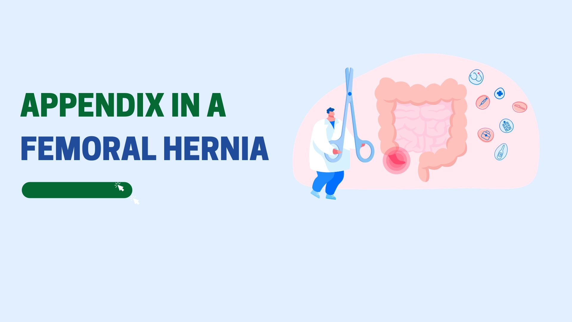 Appendix in a Femoral Hernia