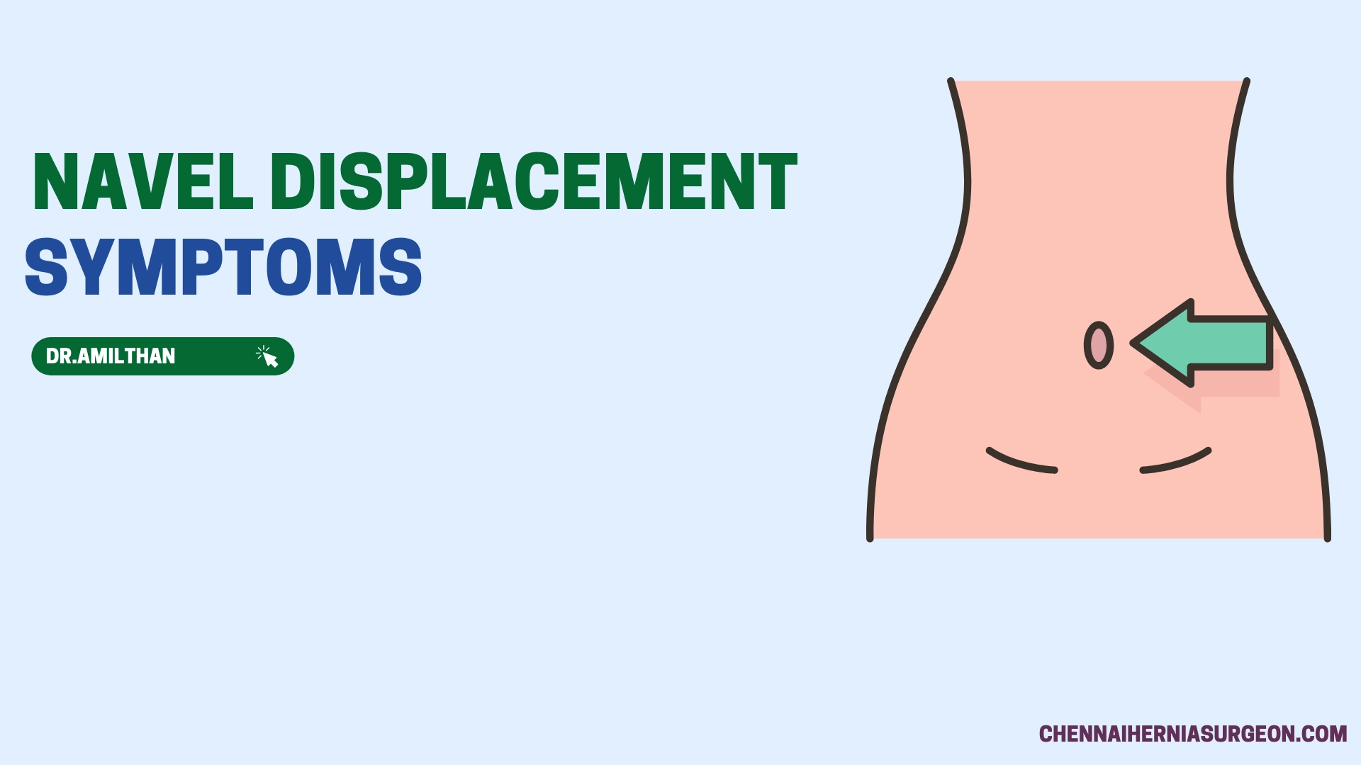 Navel Displacement Symptoms