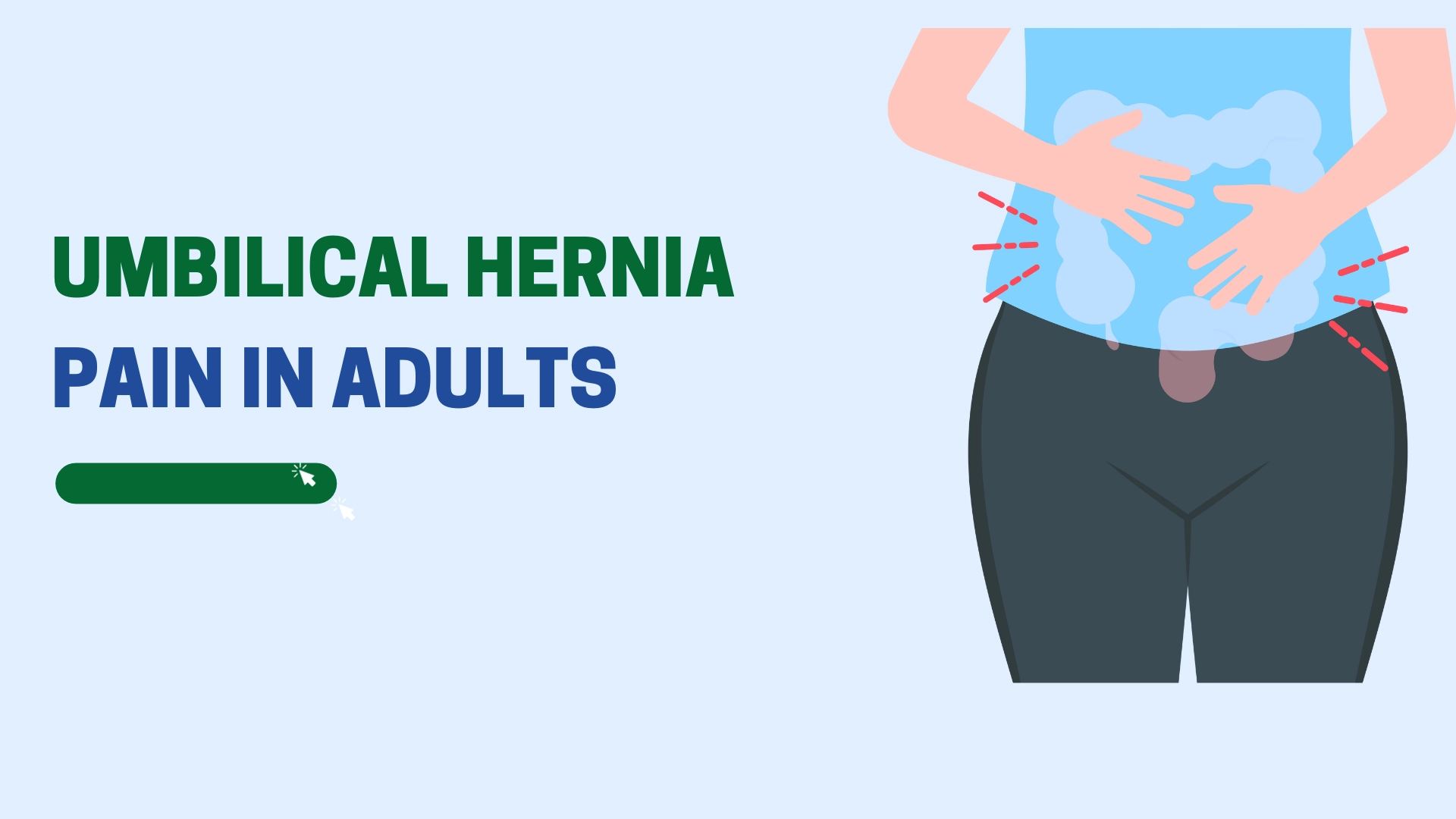 Umbilical Hernia pain in Adults