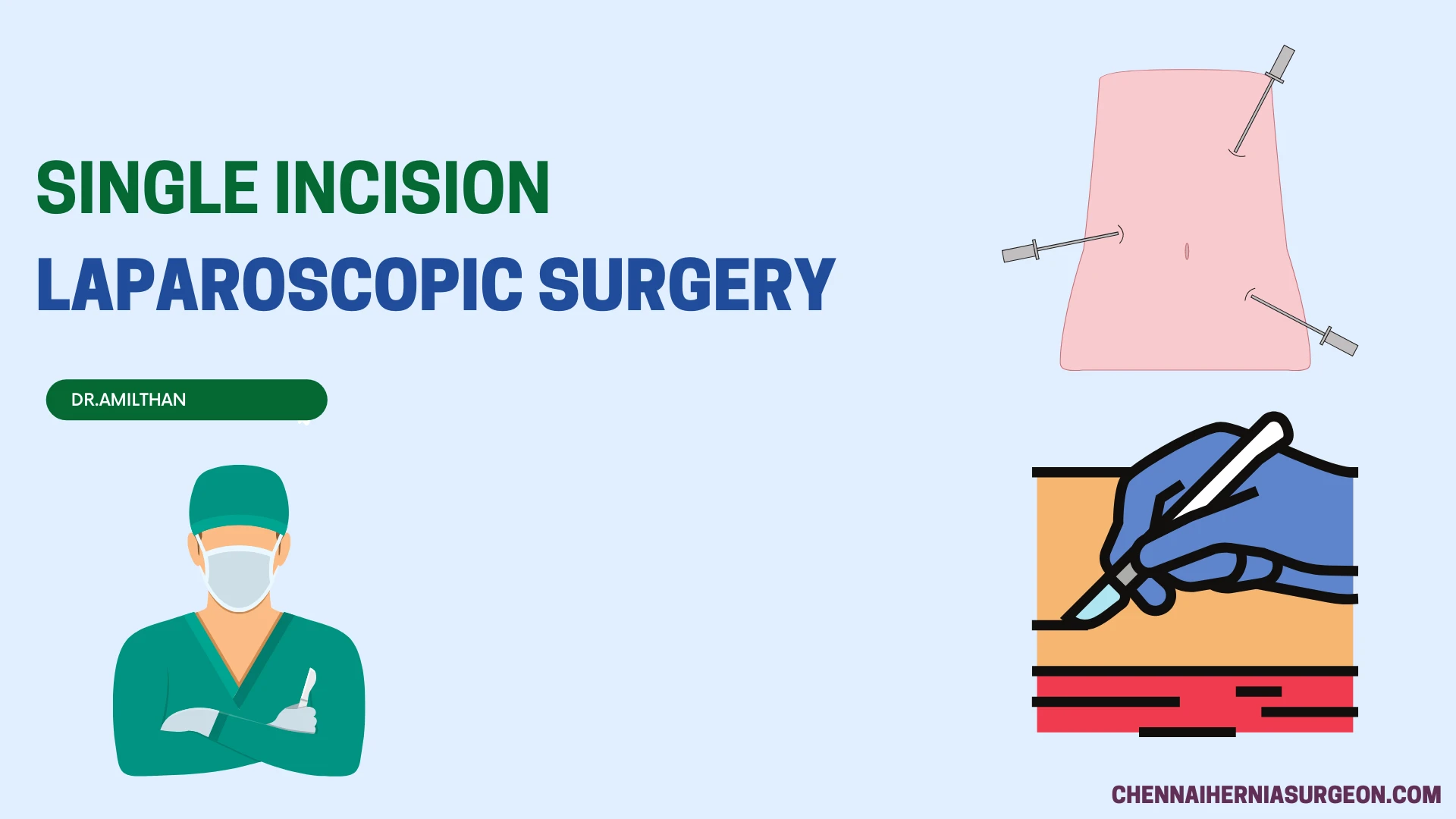 Single Incision Laparoscopic surgery