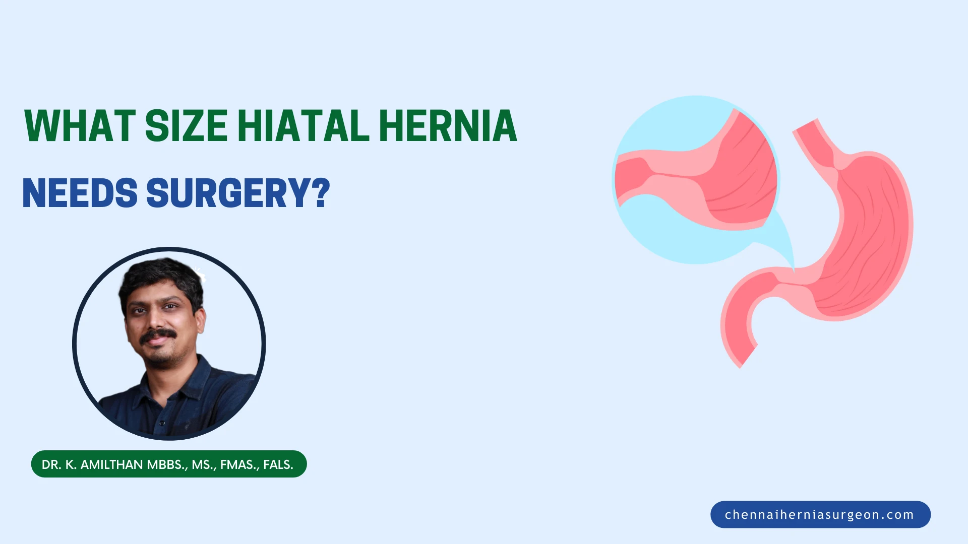what size hiatal hernia needs surgery