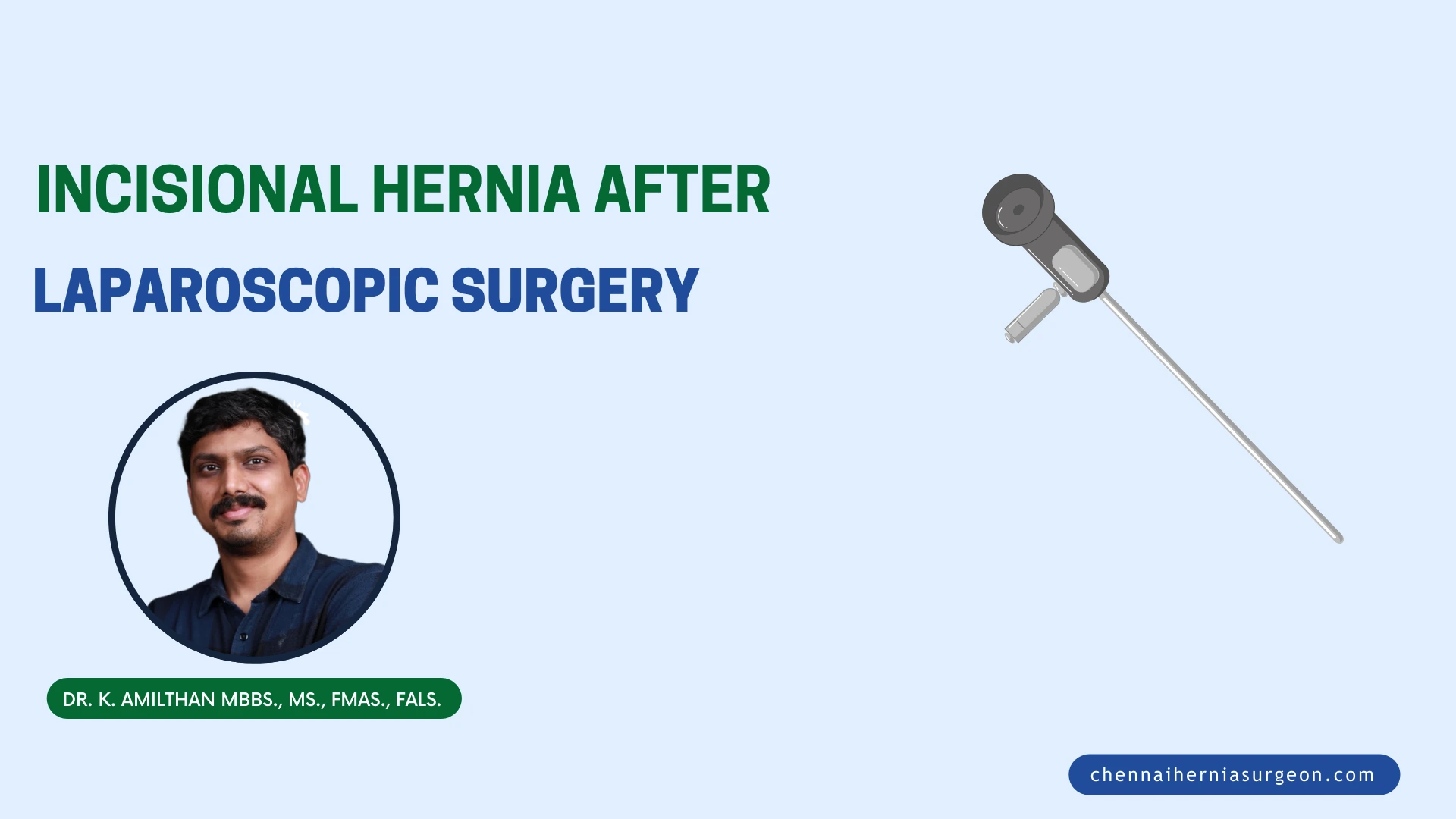 Incisional Hernia After Laparoscopic Surgery