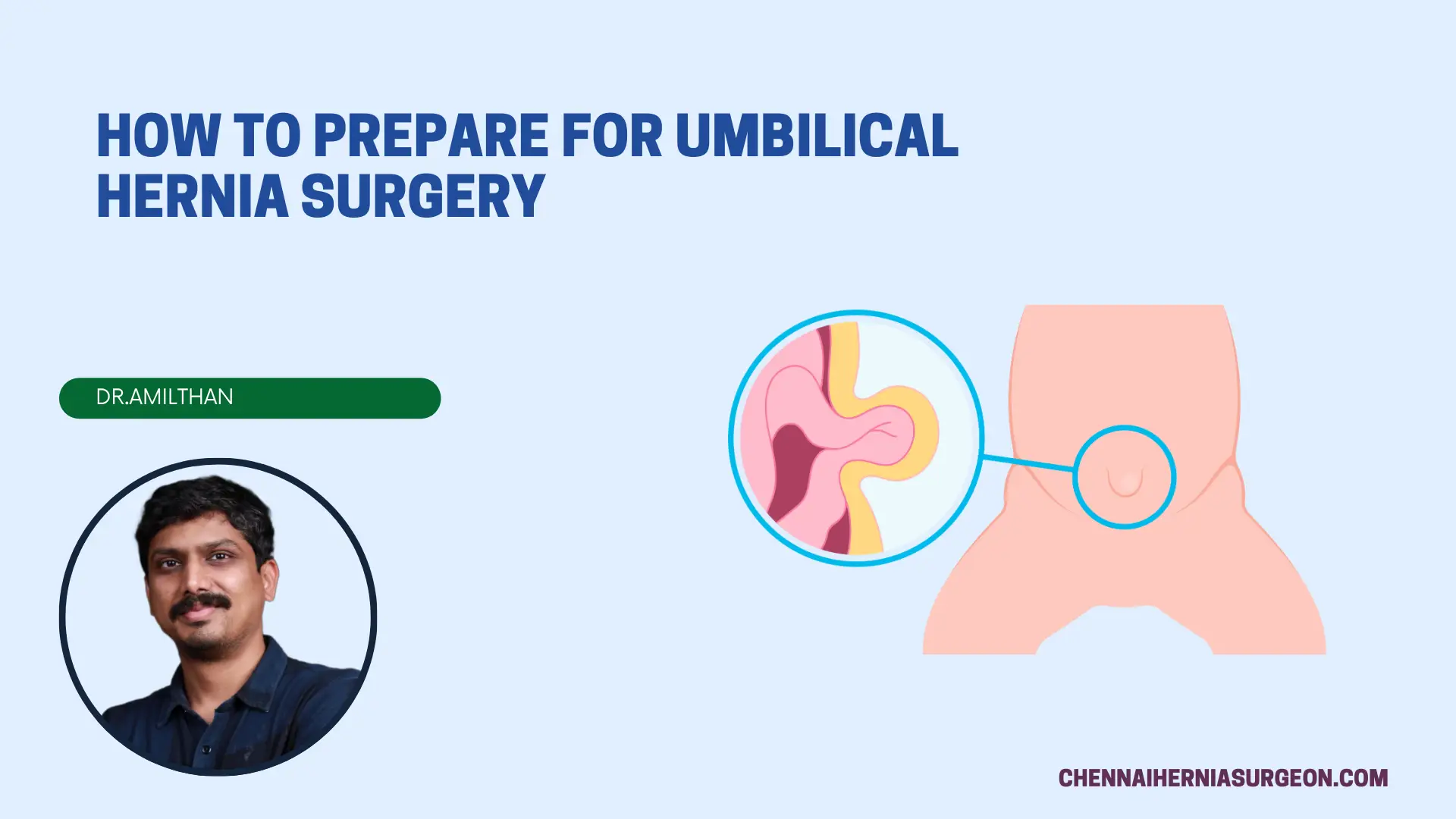 HOW TO PREPARE FOR UMBILICAL HERNIA SURGERY