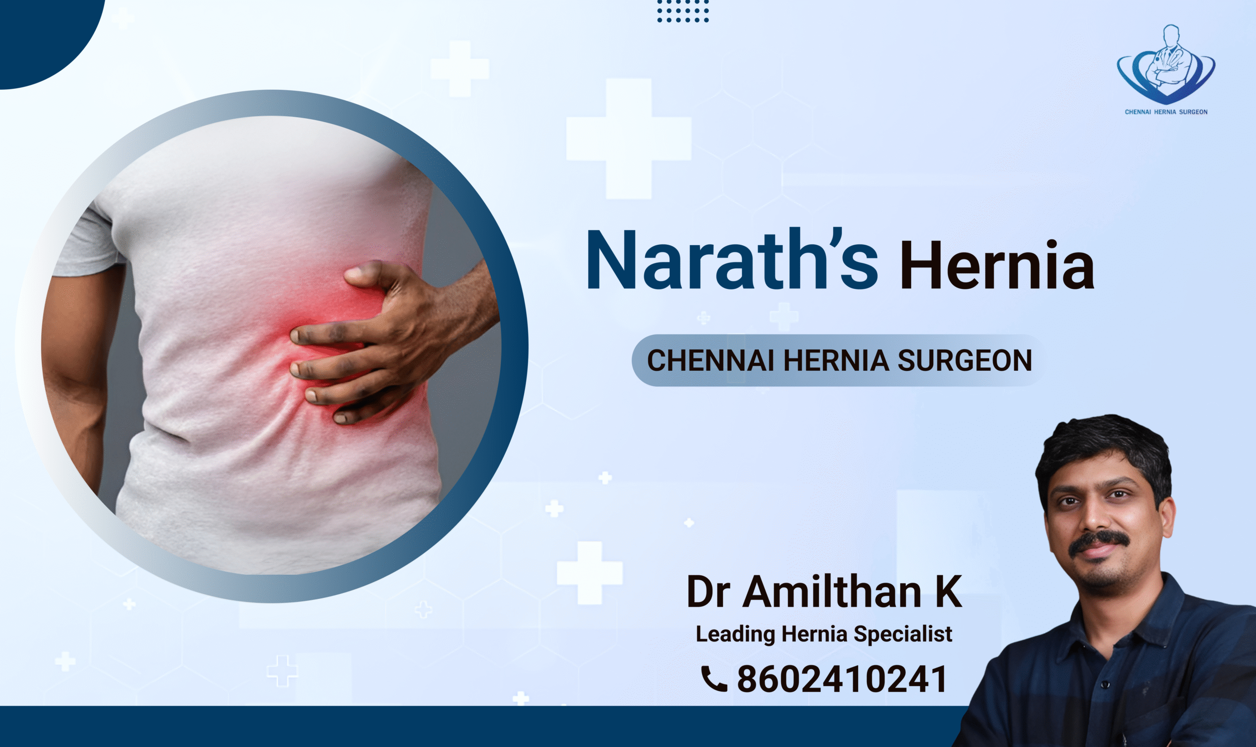 Narath’s Hernia