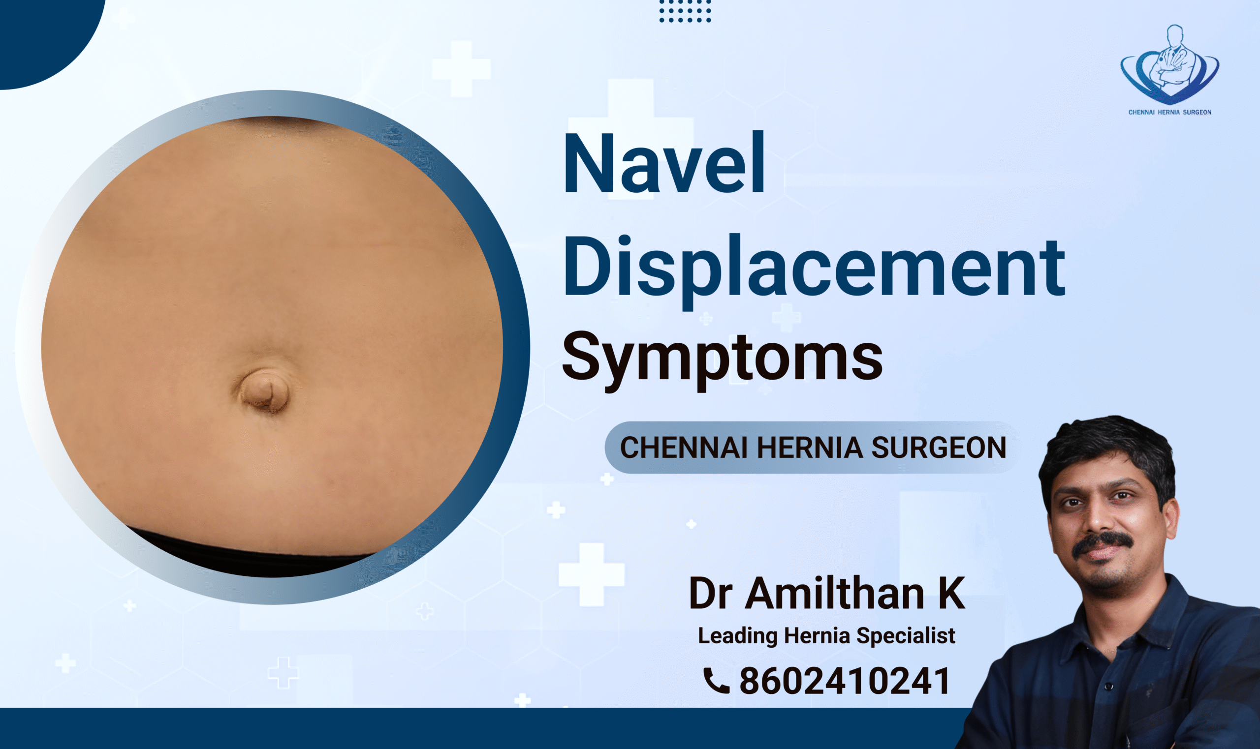 Navel Displacement Symptoms
