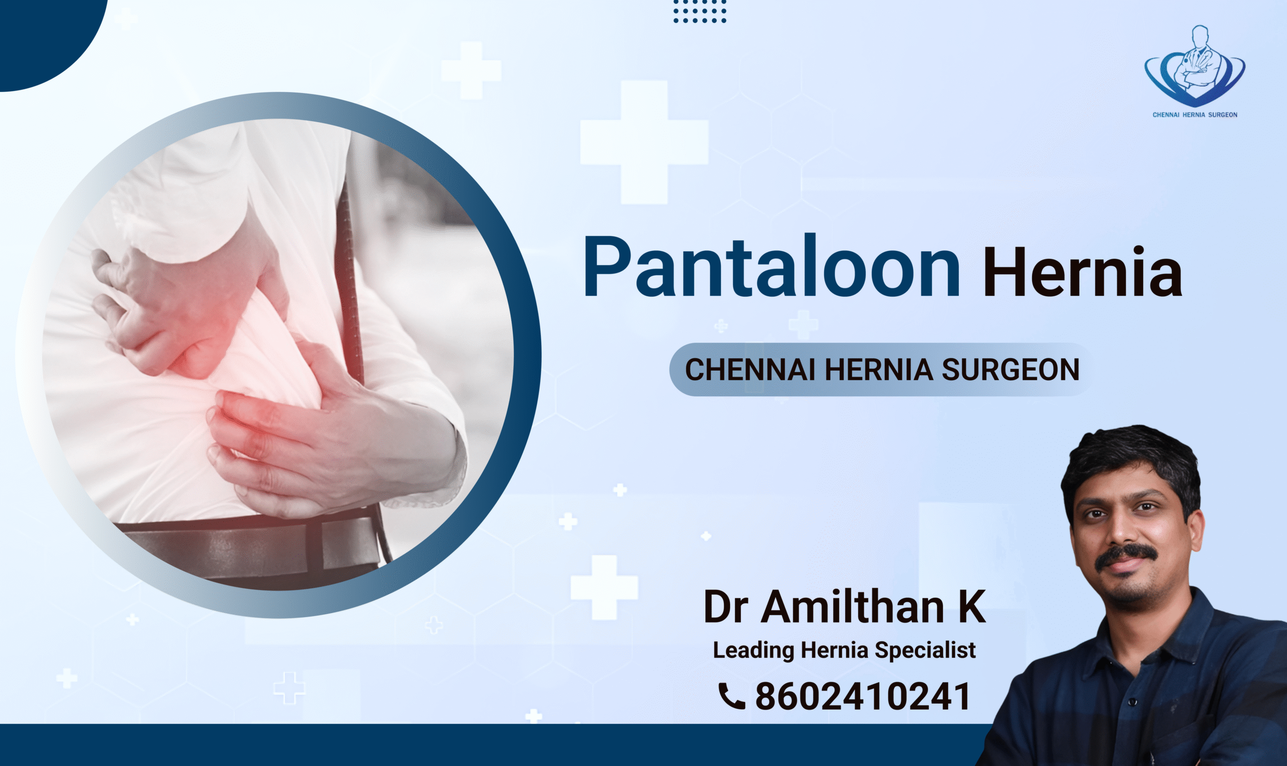 Pantaloon Hernia