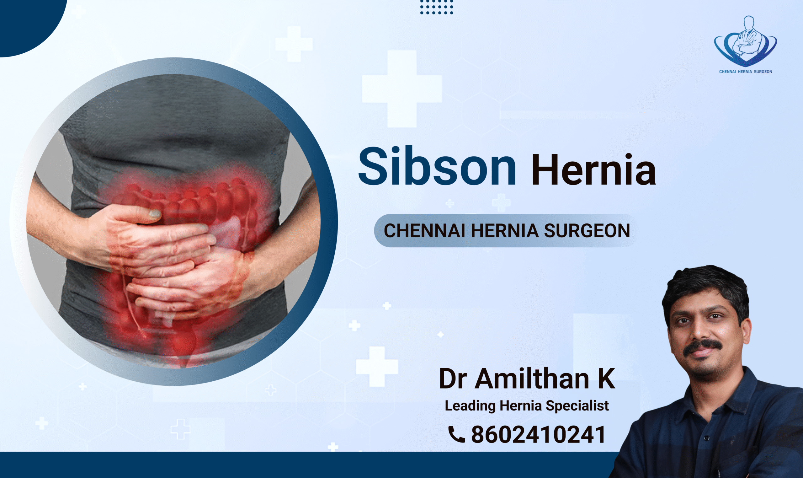Sibson Hernia